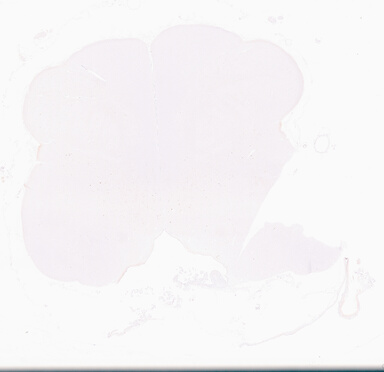 ['deident_39071c80-e36b-4b0a-93cd-4235db5b5d71_69d96b3d.jpg']