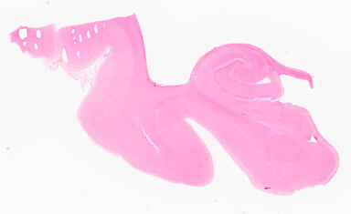 ['deident_7816752e-5f36-4b23-8444-271b27fa9d8d_69d96b6f.jpg']