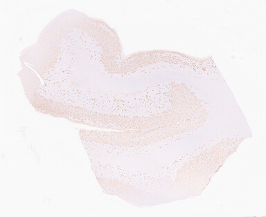 ['deident_643910f0-3d71-489c-a9c9-cc0e2d77c25a_69d96b60.jpg']