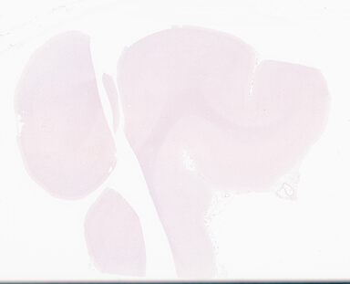 ['deident_4c847577-ec64-48eb-adf9-b40bc31f625b_69d96b4c.jpg']