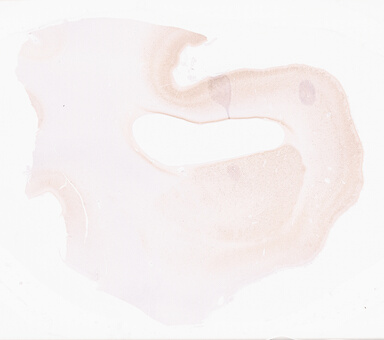 ['deident_bf694ab0-af13-43c4-be4d-adbfaf67a31f_69d96b97.jpg']