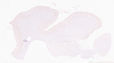 ['deident_eaeddedd-f0af-4f11-9a6e-92e38aee7794_69d96bb3.jpg']