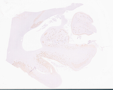 ['deident_4fe87cde-8071-496c-8611-6ac5781d44d8_69d96b55.jpg']