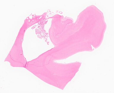 ['deident_fd2d677d-03cf-4277-b268-08c0dc68522c_69d96bb7.jpg']