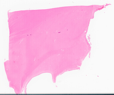 ['deident_c31f8d54-c24f-483f-9b9d-31b605653fda_69d96b99.jpg']