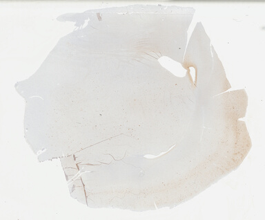 ['deident_d4f86277-49aa-47ef-8476-a6e007f3cfdb_69b02b3d.jpg']