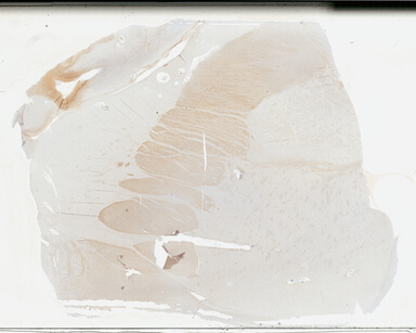 ['deident_b90b5114-4bfa-4714-b67f-9f1934c2952f_69b02b2b.jpg']