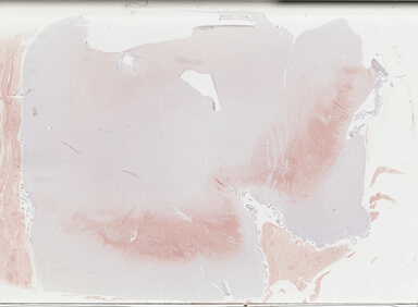 ['deident_fbc1c381-791f-4eee-b0df-f5b099fa0b13_69b02b5b.jpg']