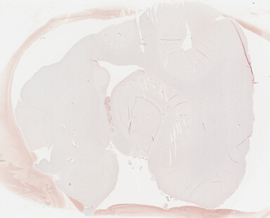 ['deident_bcb7d497-a284-4db2-adcc-fcd0bb7b671c_69b02b33.jpg']