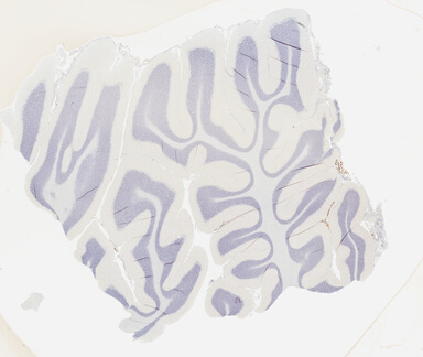 ['deident_688de333-6de0-4158-b858-2849d19e105e_69b02b13.jpg']