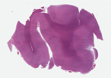 ['deident_c64c6864-d438-4528-855f-d41063933c66_69b02b34.jpg']