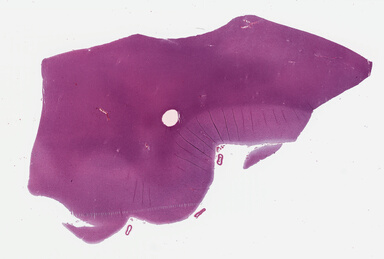 ['deident_f4dfcc4e-72e7-420a-973e-771521e80981_69b02b4c.jpg']