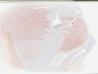 ['deident_e8be9371-ef0d-4681-b2e7-9e6b95183bb4_69b02b49.jpg']