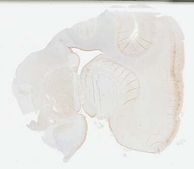 ['deident_db792577-1de1-48b6-8a7e-f532e30316fb_69b02b42.jpg']