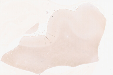 ['deident_9c996433-24d9-4ca4-ba79-61065fc7e885_69b02b21.jpg']