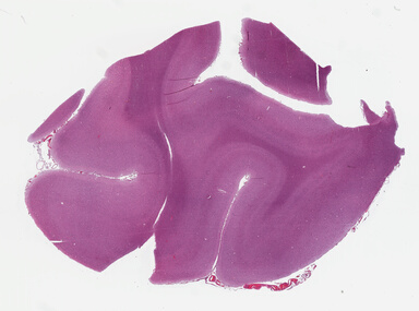 ['deident_9ad12882-ded3-4706-93d8-101af90b02e1_69b02b20.jpg']