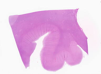 ['deident_35db4ace-003f-4fc3-8411-fd7a1dd2466d_69b05ab0.jpg']