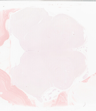 ['deident_b8438f71-a948-4e78-930b-08aa7a78af34_69b05aed.jpg']
