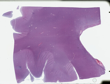 ['deident_63aa0cdc-b7b9-45f2-8a61-bdef6fc9c208_69b04a88.jpg']