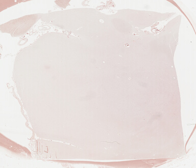 ['deident_5bf4151d-2d1c-4170-8c0c-0e178511f7d8_69b04cc8.jpg']