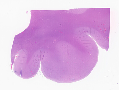 ['deident_9dda716b-2b68-461d-a7d2-964edf58cd08_69b05bb4.jpg']