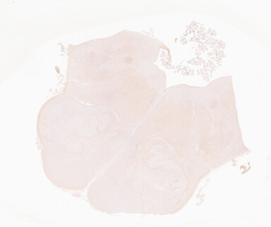['deident_507f8892-bac1-4746-9b39-45c02c2cc412_69b0504f.jpg']