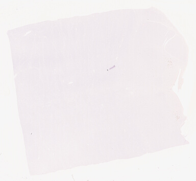 ['deident_9969155a-7578-4377-a519-9ee58f892990_69b05071.jpg']