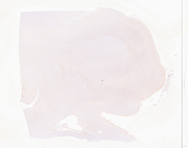 ['deident_3b360e6b-9984-4a77-b43a-c6b3ac5f80dd_69b05047.jpg']