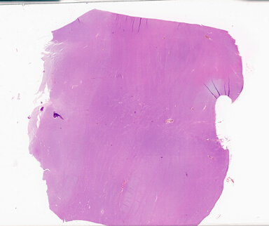 ['deident_e3ce31b3-d501-41f8-8f02-8f53abf485c0_69d9324f.jpg']