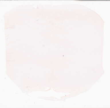 ['deident_5e02d341-4ca8-447d-b02a-b2217a49d306_69d9314c.jpg']