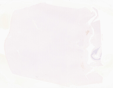 ['deident_044f48f0-05fb-469f-967c-7afc4b5dd7c3_69d94c5e.jpg']