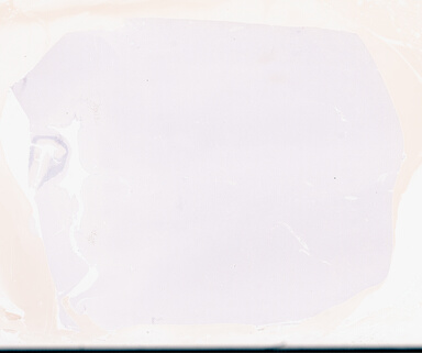 ['deident_6cd366e4-746f-4d86-a711-78334cc2b769_69d94c93.jpg']