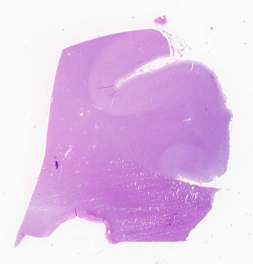 ['deident_fe5ebb43-158f-48ab-80c5-f00f47452534_69d94ce6.jpg']