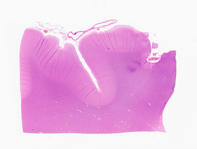 ['deident_7f656a01-5501-4299-97af-3b75e28100ae_69b0580c.jpg']