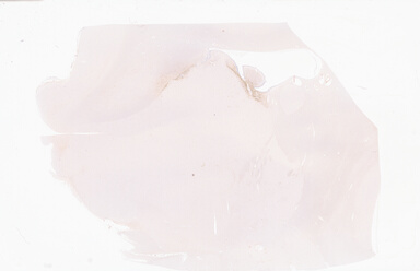 ['deident_994dd1b7-4599-475f-9da4-f8c033b530a5_69b0581e.jpg']