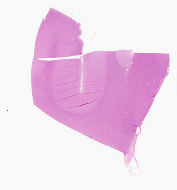 ['deident_ec4e6db9-3a44-4bad-8b30-33ac22bceda1_69d92de1.jpg']