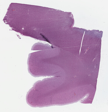 ['deident_9a35a0c7-0d1d-4cb4-81e5-6f8dff67f9e2_69b037ef.jpg']