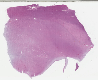 ['deident_bb914ee8-f79c-4b01-90b8-ec1f431d8315_695fca3c.jpg']