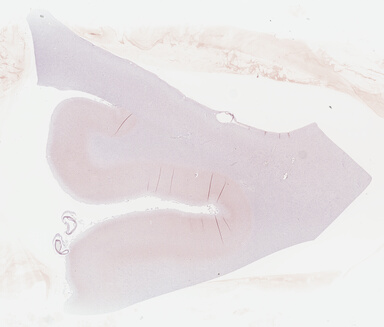 ['deident_73e4a010-ccdf-4d59-b98f-58bc70b837fc_695fca1d.jpg']