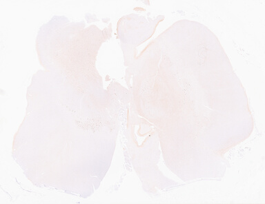 ['deident_23d7984e-9f27-4822-beb9-a3dee8afe7a4_69d964e2.jpg']