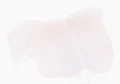 ['deident_9ef3f7c8-0327-4aaa-9ba8-165dbc6b51a7_69d9651b.jpg']