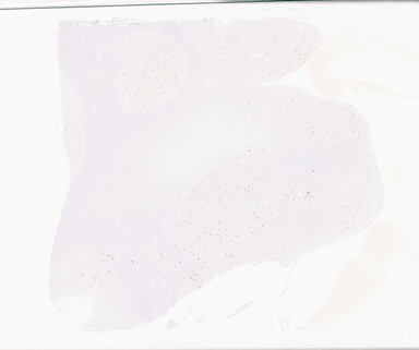 ['deident_db345a38-3ce9-4a90-a06e-4dfd4a8cdd74_69b05389.jpg']