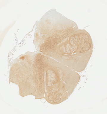 ['deident_98cbace4-cc19-49d4-b663-9205896f3672_695fc85f.jpg']