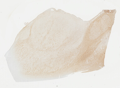 ['deident_ac49a83e-849b-4ac7-bf9d-495021216f18_695fc872.jpg']