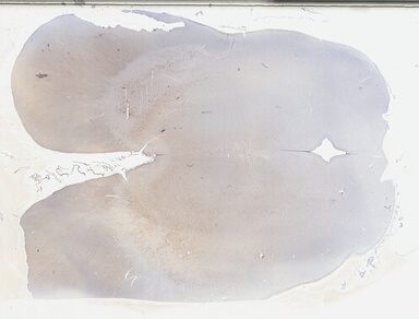 ['deident_abd1bf0c-f123-42cd-bb0a-495309834799_69b042b5.jpg']