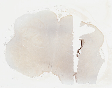 ['deident_5faebee5-6448-4b5b-b3d0-3b08f45e5ec6_69b042a0.jpg']