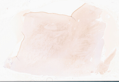 ['deident_523db77d-77c4-432a-9753-6050d76c65d8_69d95684.jpg']