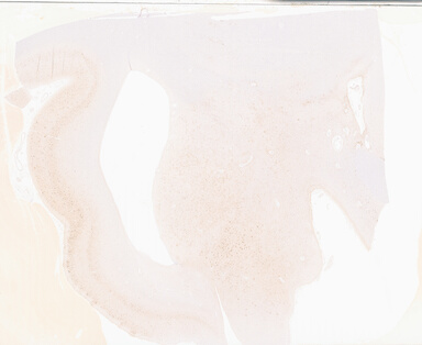 ['deident_cfbb6832-7ad9-4014-ad43-79cbf2a90018_69b05a87.jpg']