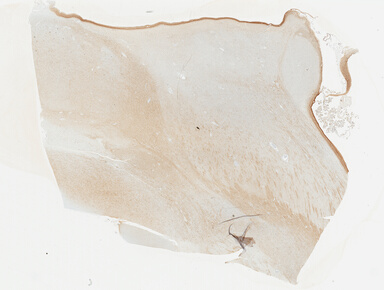['deident_f3ef6894-82d9-46a6-8754-9e3f4ee15f96_695fd1aa.jpg']