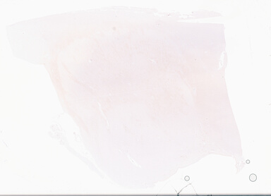 ['deident_50ee5353-7fa0-4e3f-b2fe-b01372814ae4_69d9691b.jpg']